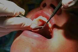 procedures to prevent gum disease